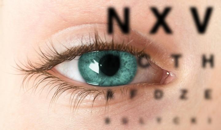 Ceratocone - Doena ocular deforma a crnea e pode causar srios danos  viso