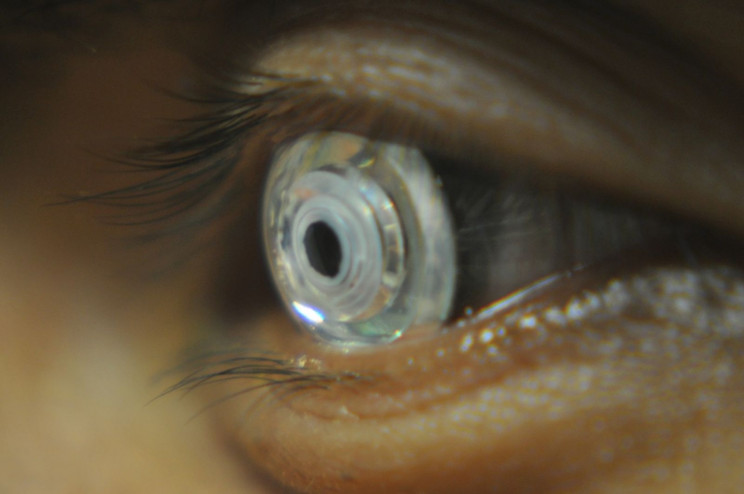 Cientistas criam lentes de contato que dão zoom quando você pisca duas vezes
